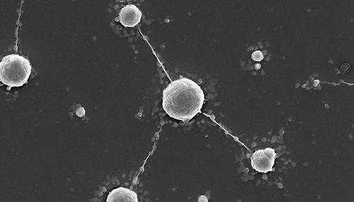 Wolframpolyoxometallate als lebenserhaltende anorganische Strukturen. Auf wolframhaltigem W-POM kultivierte Kolonien von M. sedula bestehen aus einzelnen Zellen, die durch extrazelluläre Extensionen verbunden sind