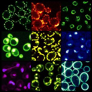 Das Bild zeigt verschiedene zelluläre Strukturen der Hefe, die alle von Membranen umschlossen sind. Bei der Zellteilung werden diese Strukturen verdoppelt, was die Synthese entsprechender Membran-Lipide voraussetzt.