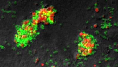 Cyanat-abbauendes Konsortium aus Ammoniak- (rot) und Nitrit-oxidierenden Mikroben (grün). Die Mikrobengruppen wurden mit Hilfe der Fluoreszenz-In-Situ-Hybridisierung spezifisch angefärbt.