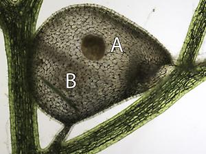Falle des Südlichen Wasserschlauchs (Utricularia australis) mit einem toten Wasserfloh (A) und einer gefangenen Zieralge (B; Pleurotaenium sp.)