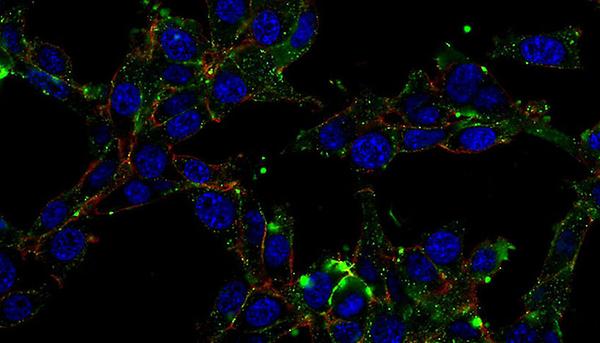 Albumin Uptakes in Zellkultur oder Tumorgewebe: blau: Nukleus, rot: Zellmembran, grün: Albumin