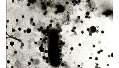 Wasserprobe mit dem Transmissionselektronenmikroskop zeigt ein Bakterium umgeben von Viren