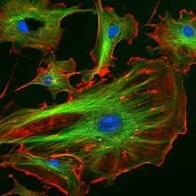 Zu sehen sind Endothelzellen unter dem Mikroskop, deren Zellkerne, Mikrotubuli, Antikörper und Aktinfilamente mit verschiedenen Fluoreszenzfarbstoffen angefärbt sind.