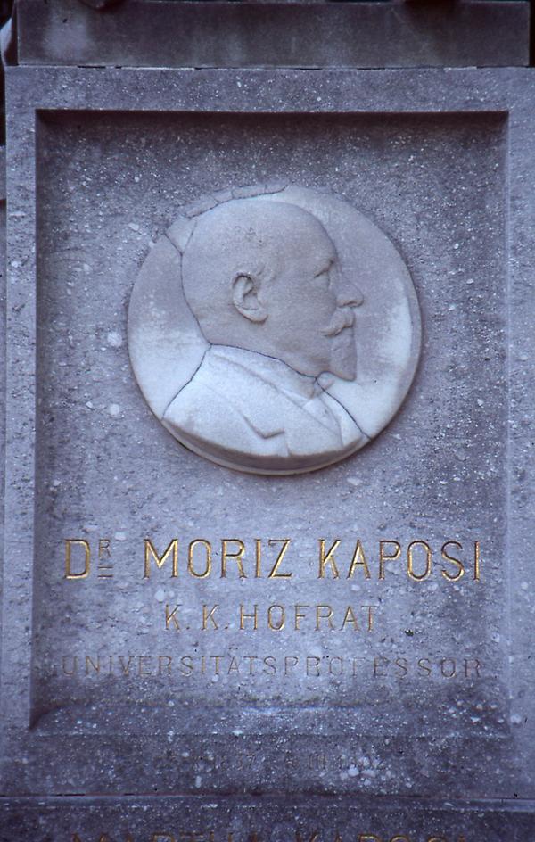 Moritz Kaposi