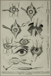 Auge (Tafel II)