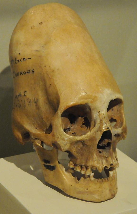 Ica - Musem; Skull Deformations