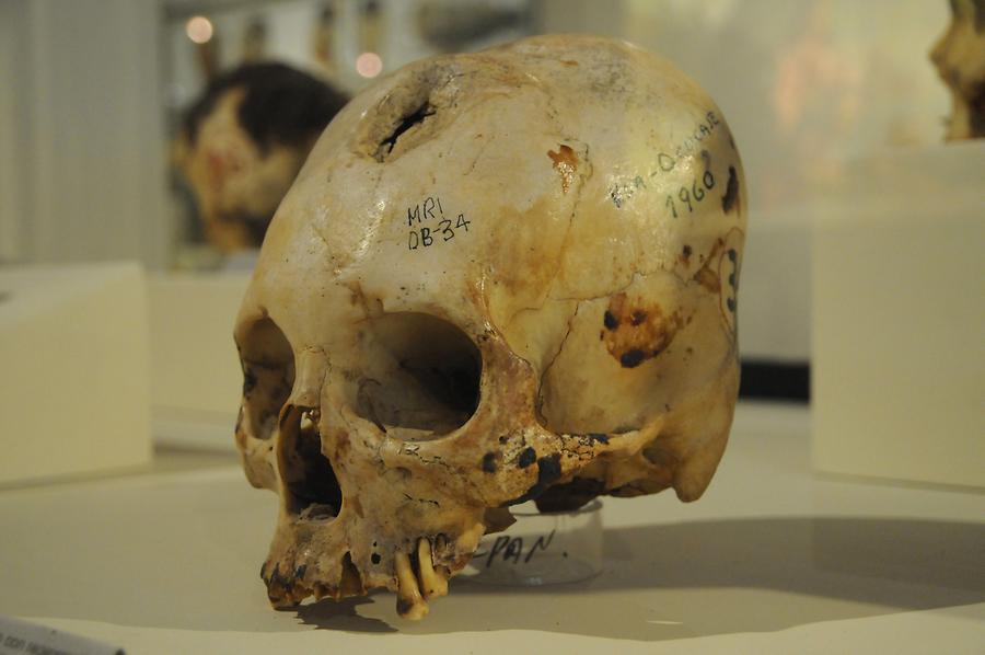 Ica - Musem; Trepanation