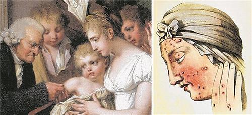 An Pocken erkrankte Frau, 18. Jahrhundert