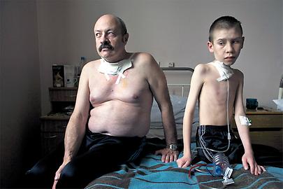 Krebspatienten. Oleg Schapiro, 54, und Dima Bogdanowitsch, 13