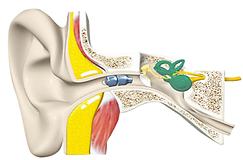 Miniaturisierung und den technischen Komfort von Hörgeräten und -implantaten