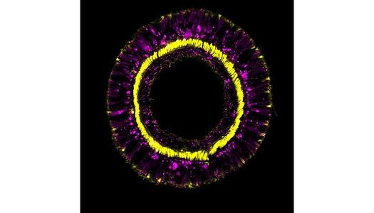 Abb. 1 : Querschnitt durch einen Tentakel einer transgenen Seeanemone, die Differenzierungsprodukte der SoxC Zellpopulation (magenta) zeigt und Retraktormuskeln (gelb)