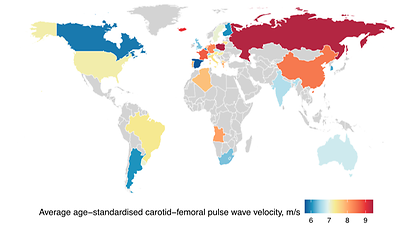 BU: Die Pulswellengeschwindigkeit variiert stark zwischen verschiedenen Ländern. Während sie in Polen, Russland, Island, Frankreich und China am höchsten ist, ist sie in Spanien, Belgien, Kanada, Finnland und Argentinien am niedrigsten.