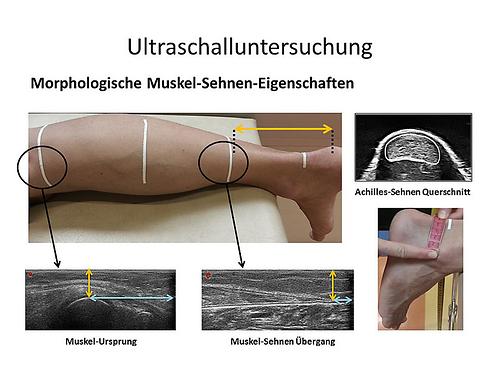 Mithilfe von Ultraschall wurde das elementare Zusammenspiel von Muskel und Sehne beobachtet., Fotos: Uni Graz/Annika Kruse
