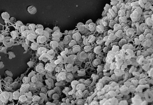 Elektronenmikroskopische Aufnahme eines Zell-Aggregats von Comammox-Bakterien