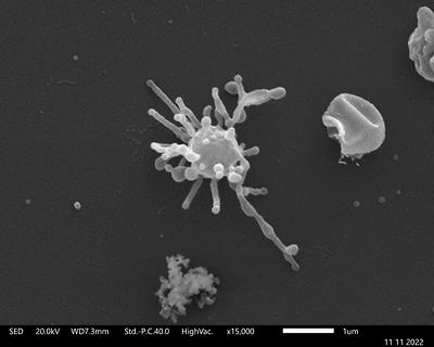 Abbildung 2: Rasterelektronenmikroskopische Aufnahme einer Zelle von Lokiarchaeum ossiferum, auf der man die langen Zellfortsätze erkennen kann. (© Thiago Rodrigues-Oliveira, Univ. Wien)