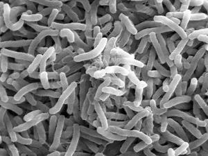 Cholera-Bakterien unter dem Mikroskop