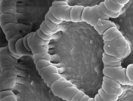 Abbildung 2: Mikrostruktur von Sporopollenin eines Pollenkorns