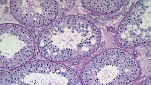 Histologischer Schnitt durch normales Hodengewebe eines jungen Mannes