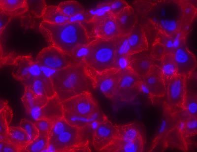 Die Abbildung zeigt humanes, regenerierendes Lebergewebe nach Metastasenresektion. Während des Regenerationsprozesses wird das PIDDosom aktiv, um Zellteilungsfehler vorzubeugen.