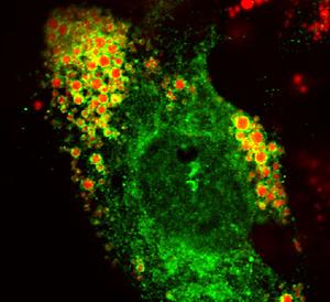 Fluoreszenzmarkiertes G0S2 (grün) auf der Oberfläche von gespeicherten Lipidtröpfchen (rot)