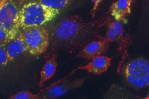 Mikroskopische Aufnahme von Kupfferzellen (rot umrandet) und primären Hepatozyten nach 48h. Das Cholesterin (grün) wurde fast vollständig an die primären Hepatozyten abgegeben.