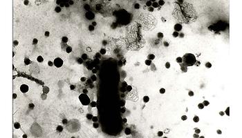 Wasserprobe zeigt ein Bakterium umgeben von Viren