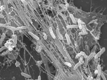 NETs mit Bakterien aus einem Laborexperiment