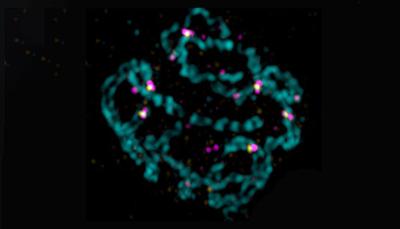 Bild eines Kerns, der sich zu einer Eizelle entwickeln wird, dargestellt mithilfe einer Technik namens 'Structured Illumination Microscopy'