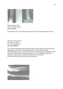 Image of the Page - 24 - in Das Lazarett in der Frauenstrafanstalt - Bericht von med. Heinrich Wallnöfer über die Arbeit mit der Siemens’schen Metallsuchersonde