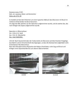 Image of the Page - 25 - in Das Lazarett in der Frauenstrafanstalt - Bericht von med. Heinrich Wallnöfer über die Arbeit mit der Siemens’schen Metallsuchersonde