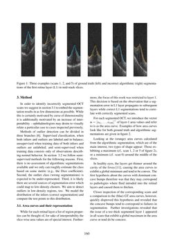 Bild der Seite - 160 - in Joint Austrian Computer Vision and Robotics Workshop 2020