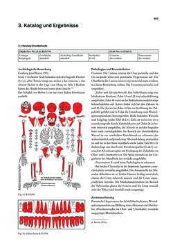 Image of the Page - 303 - in Das linearbandkeramische Gräberfeld von Kleinhadersdorf
