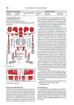 Image of the Page - 304 - in Das linearbandkeramische Gräberfeld von Kleinhadersdorf