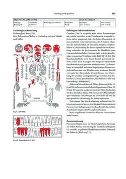 Image of the Page - 307 - in Das linearbandkeramische Gräberfeld von Kleinhadersdorf