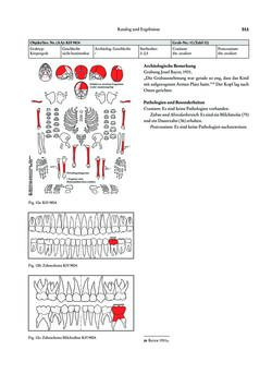 Image of the Page - 311 - in Das linearbandkeramische Gräberfeld von Kleinhadersdorf
