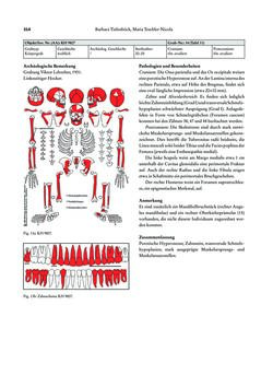 Image of the Page - 314 - in Das linearbandkeramische Gräberfeld von Kleinhadersdorf
