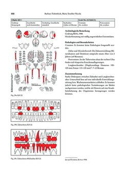 Bild der Seite - 332 - in Das linearbandkeramische Gräberfeld von Kleinhadersdorf