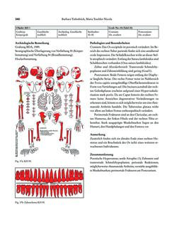 Image of the Page - 340 - in Das linearbandkeramische Gräberfeld von Kleinhadersdorf