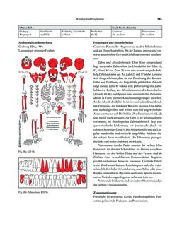 Image of the Page - 341 - in Das linearbandkeramische Gräberfeld von Kleinhadersdorf
